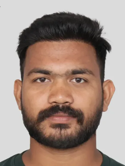 A 10-month transformation for a patient with diffuse pattern baldness. With 2400 grafts, we restored his look and confidence.