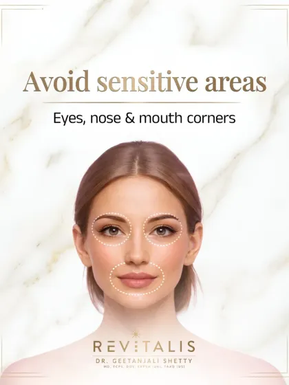 Retinol Rule: Avoid Sensitive Areas. Be careful to avoid the delicate skin around your eyes, the corners of your nose, and your mouth to prevent redness and peeling.