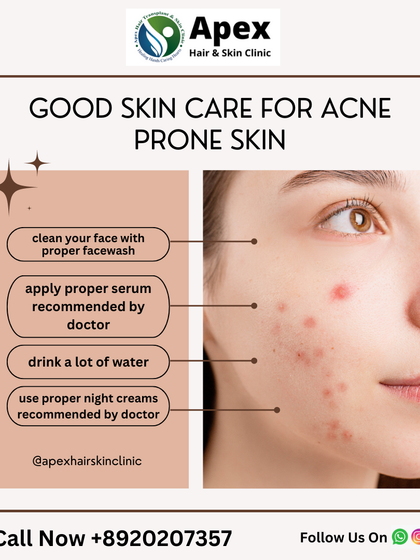 Proper daily care is essential for managing acne-prone skin. We recommend a simple, effective routine that includes a gentle facewash and doctor-recommended serums. Our experts can help you build the perfect regimen to complement your in-clinic treatments.