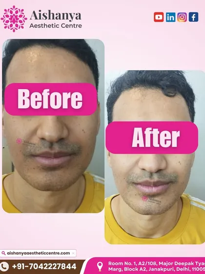 A great example of a premium facial's effect. The client's skin appears refreshed, with a visible reduction in dullness and a healthier, more hydrated look after the treatment.