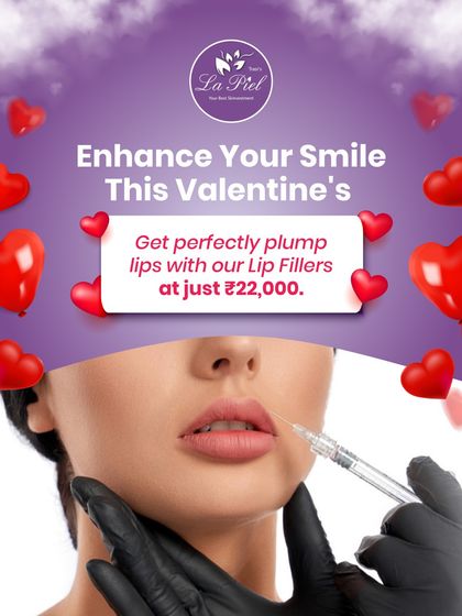 To help our patients enhance their smiles for Valentine's Day, we offered a special price on our Lip Filler treatments. This procedure adds natural-looking volume and definition for perfectly plump lips.
