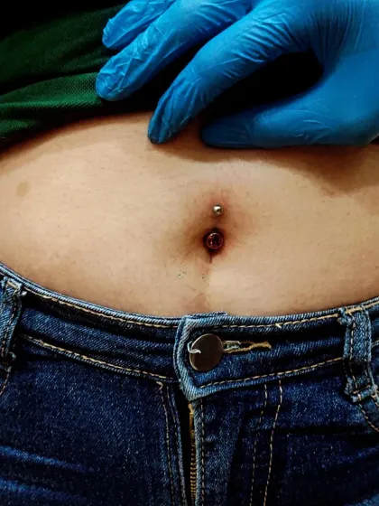 Here is a close-up of a navel piercing immediately after it's done, showing my focus on hygiene with sterile tools and gloves. Some initial redness is normal and part of the healing process.