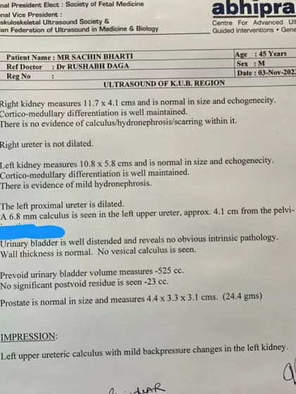 This is the "before" report. A patient's ultrasound from November 2023 clearly shows a 6.8 mm kidney stone, which was causing him extreme pain. This is the clinical starting point of our treatment journey.