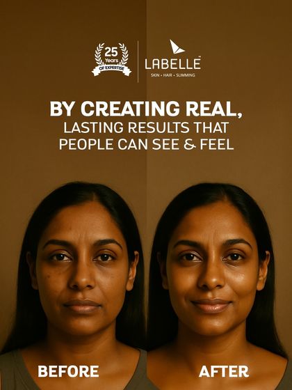 LaBelle - Advanced Skin & Facial Treatments Our Expertise & Technology photo 12