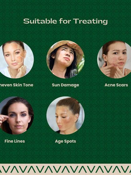 Sree Vasavi - Anti-Aging & Skin Tightening Advanced Skin Rejuvenation: Lasers & Peels photo 3