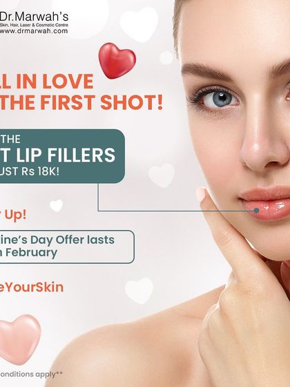 This graphic highlights a Valentine's Day promotion for lip fillers. We use these treatments to provide natural-looking hydration and subtle volume, enhancing the lips for a refreshed appearance.
