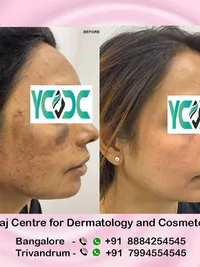 Medical Dermatology