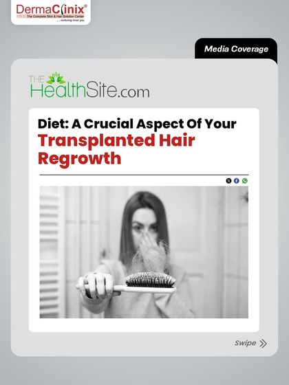This media coverage from TheHealthSite.com emphasizes that diet is a crucial aspect of your transplanted hair's regrowth. We provide comprehensive guidance for your entire journey.