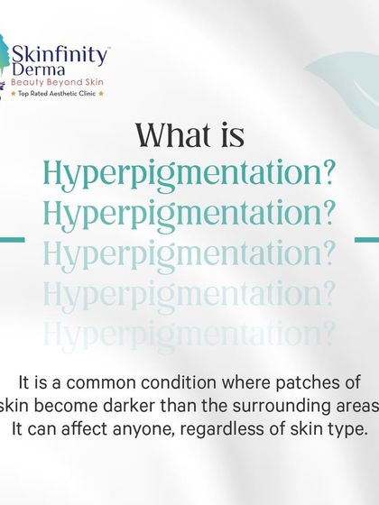 What is hyperpigmentation? It's a common condition where patches of skin become darker than the surrounding areas. This post is the start of our series to help you understand and tackle it effectively.