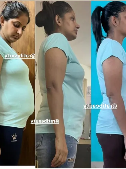 Vikas saw a 9 kg drop, going from 72 kg to 63 kg. Her side-profile transformation shows a significant reduction in belly fat and a change in posture.