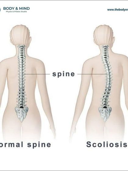 Body & Mind PhysioPilates Studio - Physical Therapy & Rehabilitation Back & Spine Health photo 17