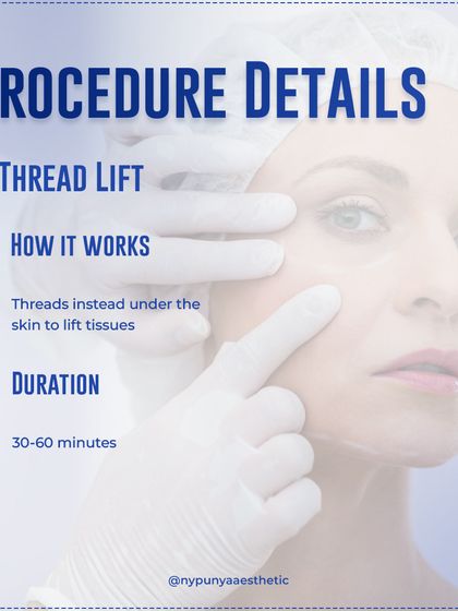 A thread lift procedure is relatively quick, typically taking 30 to 60 minutes. We insert dissolvable threads under the skin to lift the tissues into a more youthful position.