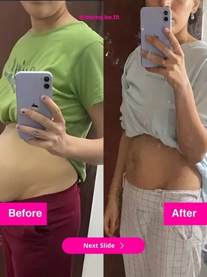 This before and after shows a mama who went from a 4-finger diastasis recti gap and low energy to a significantly reduced gap and a stronger, healthier body in just 3 months.