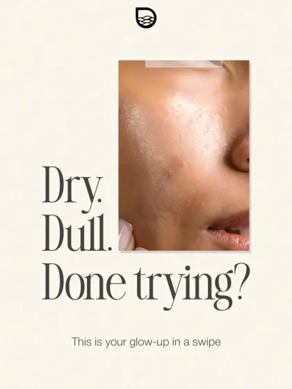 For skin that is dry, dull, and not responding to creams, Profhilo is the answer. This image captures the problem and presents my injectable hydration therapy as the solution for a true glow-up.