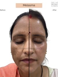 Medical-Grade Facials