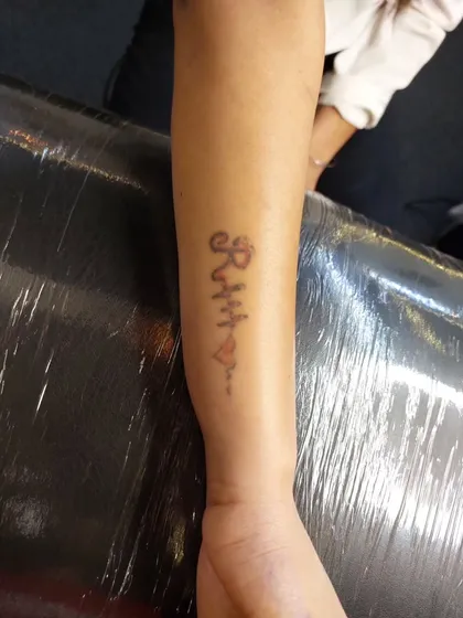This faded name tattoo is ready for its final removal sessions or to be lightened enough for a cover-up. We create a plan based on your specific goal.