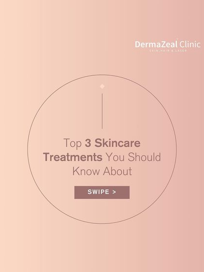This graphic introduces three top skincare treatments you should know about. Understanding options like chemical peels, carbon laser peels, and microdermabrasion helps you make informed choices.