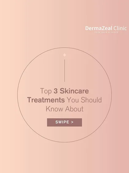 This graphic introduces three top skincare treatments you should know about. Understanding options like chemical peels, carbon laser peels, and microdermabrasion helps you make informed choices.