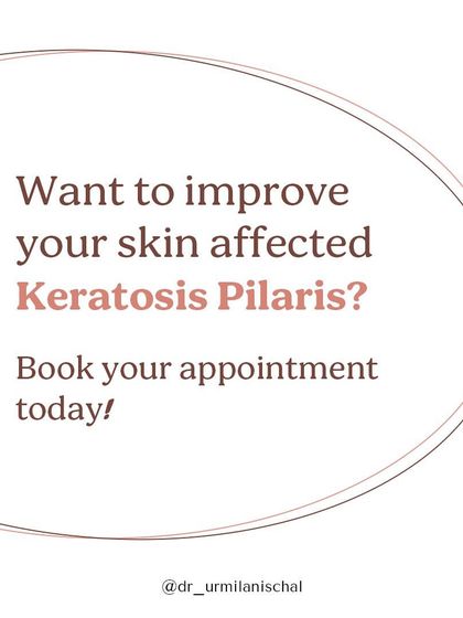 Urmila Nischal - Medical Dermatology Body & Specialized Skin Concerns photo 22