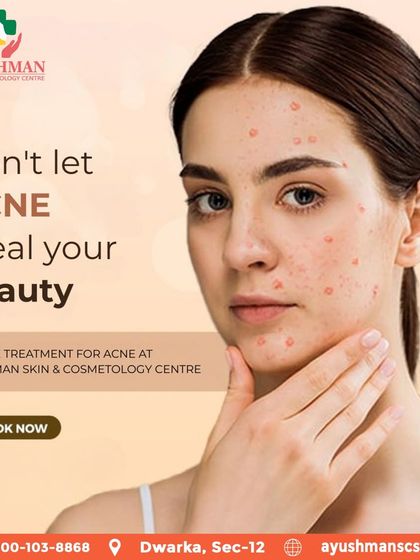 Don't let acne define your beauty. I provide effective, professional treatments at the clinic to help you regain control and achieve the clear skin you deserve.