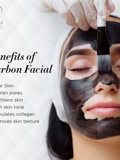 This graphic lists the many benefits of a Carbon Facial, including clearer skin, tighter pores, and a brighter, even skin tone.