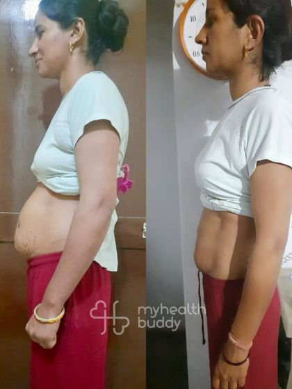 This mom of two toddlers was dealing with belly fat, fatty liver, and Diastasis Recti. Through a simple plan of home food and consistent exercise, she took control of her health and saw incredible changes in just 3 months.