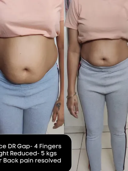 A duplicate of image 211, showing the same impressive transformation: 5 kgs lost, 4-finger DR gap reduction, and lower back pain resolved.
