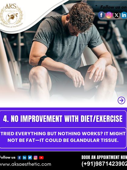 Have you tried diet and exercise with no improvement in your chest area? This is a strong indicator that the issue might be glandular tissue from gynecomastia, not just stubborn fat.