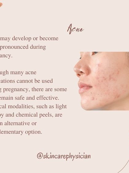 Many women experience new or worsening acne during pregnancy. It's important to know that you don't have to just endure it, as we have several safe treatment modalities available.