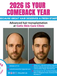 Hair Restoration & Treatment