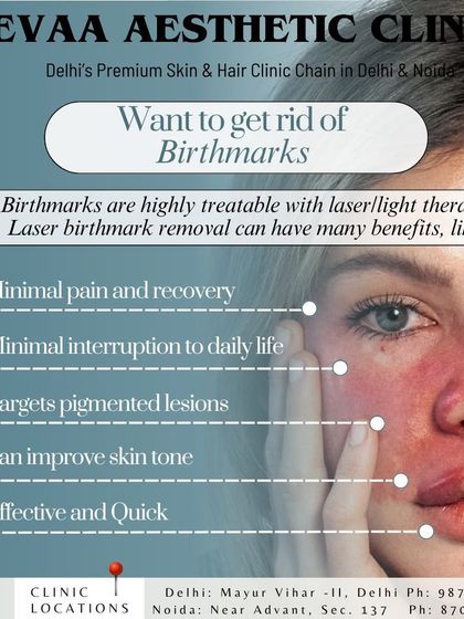 An informational graphic on the benefits of laser birthmark removal. This highly treatable condition can be addressed with minimal pain, recovery, and interruption to daily life.