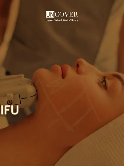A close-up of a HIFU facial treatment. The grid markings help us ensure precise, even delivery of ultrasound energy across the target area for optimal lifting and tightening.