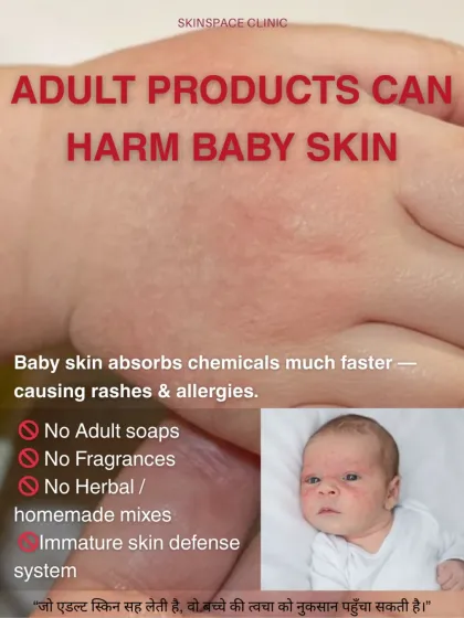 This graphic clearly shows why adult products, even herbal or homemade remedies, can harm a baby's sensitive skin. Their immature skin defense system cannot handle the ingredients, leading to rashes and allergies.