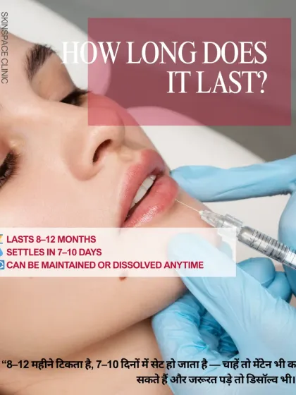 Our lip filler treatments last approximately 8-12 months and settle within 7-10 days. The results can be maintained with touch-up sessions, or the filler can be dissolved at any time if needed, offering you complete control.