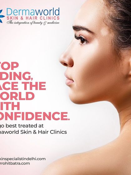 Vitiligo can be a source of self-consciousness, but you do not have to hide. With the right treatment and support, you can face the world with confidence. I offer effective treatments to manage this condition.