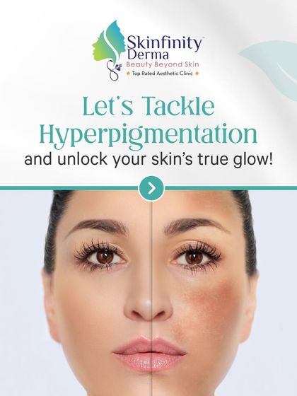 Let's tackle hyperpigmentation and unlock your skin's true glow. This image shows a powerful before-and-after, illustrating the potential to achieve an even and radiant complexion with the right treatments.