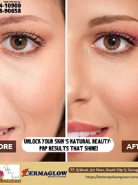 Pigmentation & Skin Tone Correction
