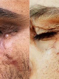 Cosmetic Dermatology