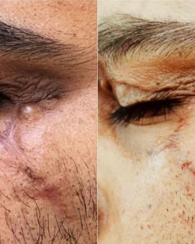 Cosmetic Dermatology