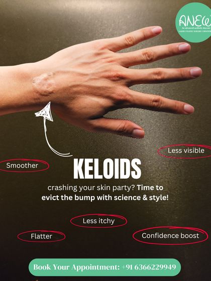 Keloids can crash your skin party, but it's time to evict the bump with science. Our treatments make keloids flatter, less itchy, and less visible, providing a significant boost to your confidence.