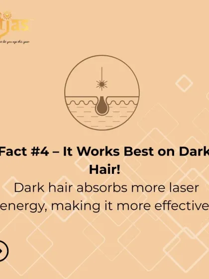 Fact: Laser hair reduction is most effective on dark hair. The laser's energy is absorbed by the melanin (pigment) in the hair, so darker hair absorbs more energy, leading to a more effective treatment of the follicle.