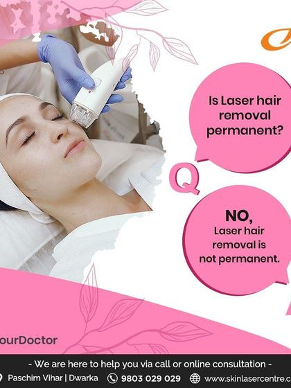 A common question I get is whether laser hair removal is permanent. The answer is no, it provides long term reduction, not permanent removal. The hair that does regrow is usually finer and less noticeable.