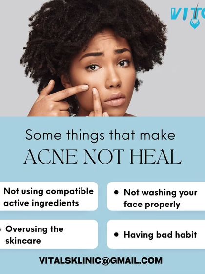 Vitals Klinic - Aesthetic Dermatology Acne & Scar Solutions photo 14