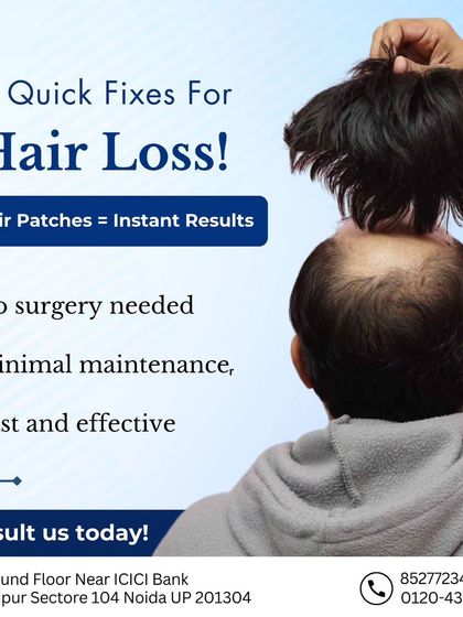 Looking for a quick fix for hair loss? This graphic highlights the key benefits of hair patches: they require no surgery, need minimal maintenance, and are a fast and effective solution.