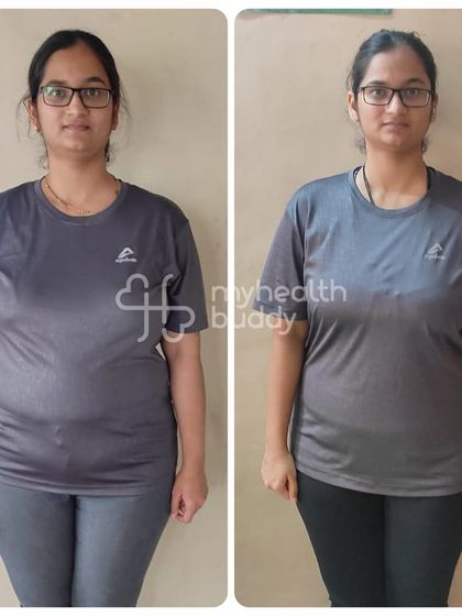 Kshitija lost 11 kgs in 3 months post-pregnancy. We started with simple diet changes, regular walks, and beginner-friendly home workouts.