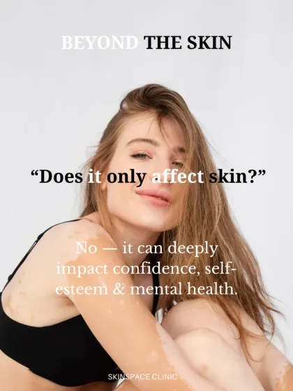 Beyond the physical appearance, vitiligo can deeply impact a person's confidence and self-esteem. Our care approach is not just about treating the skin but also supporting the individual's mental well-being.