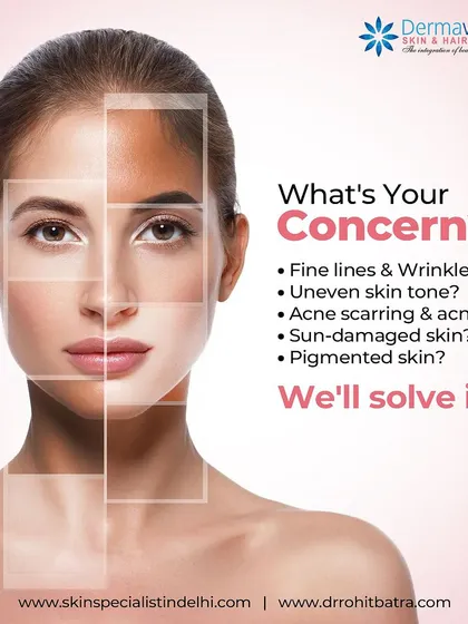 Fine lines, uneven skin tone, acne, or sun damage. Whatever your concern is, there is a scientific solution. This visual represents my core philosophy: identifying your specific issue and creating a targeted, effective treatment plan to solve it.