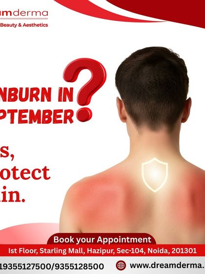 Sunburn isn't just a summer problem; UV rays in September can be just as harmful. This post reminds you to protect your skin year-round. We offer treatments to both protect your skin and rejuvenate it from sun damage.