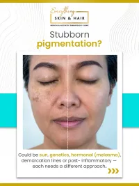 Skin Brightening & Pigmentation Correction