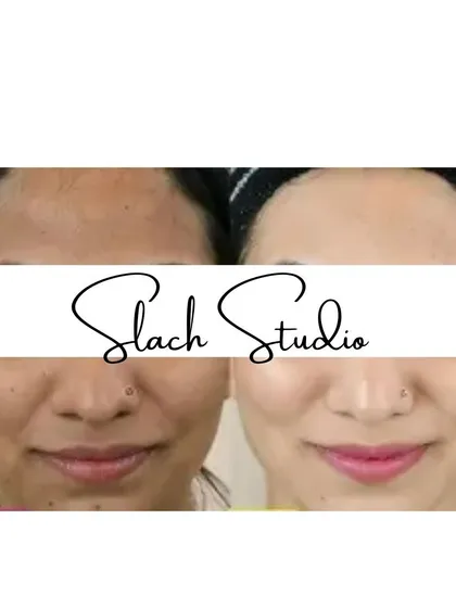 This before-and-after demonstrates a significant lightening of the skin tone and a reduction in fine lines and spots.
